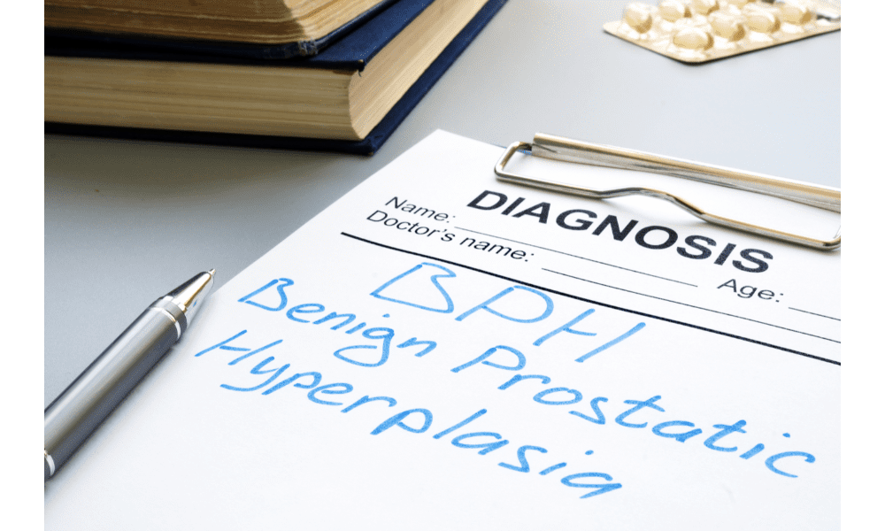 Benign Porostatic Hyperplasia (BPH) diagnosis