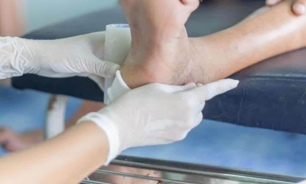 Dressing diabetic foot ulcers