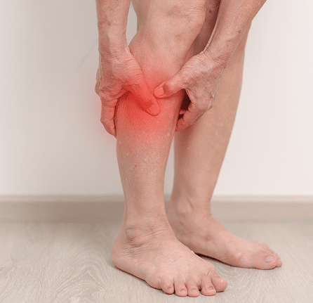 Leg Pain:Ulcers@1x Leg