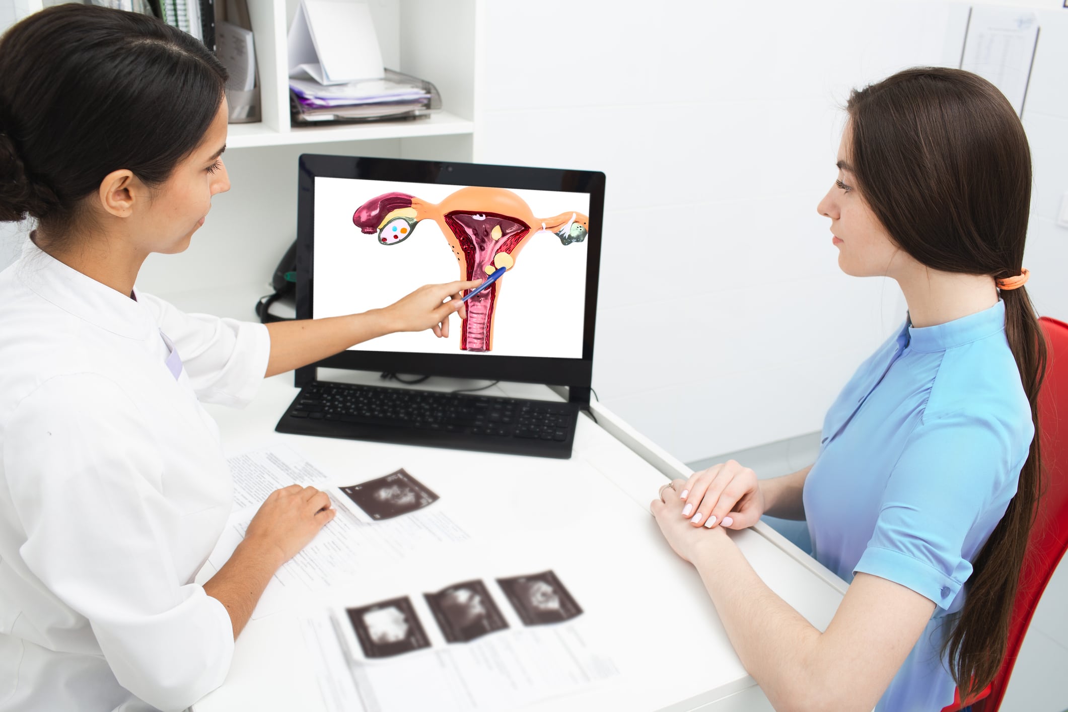 A doctor talking to a woman about uterine fibroids