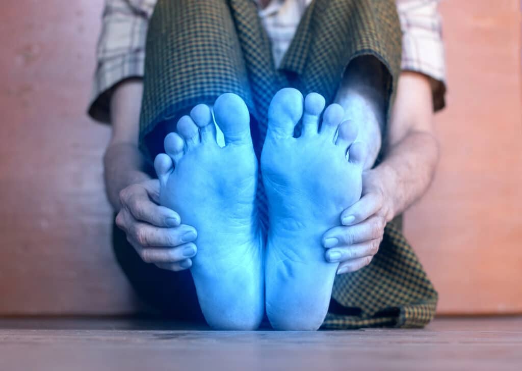 Light blue colored feet of elder man. Concept of tingling and numbness or cold and clumsy foot.