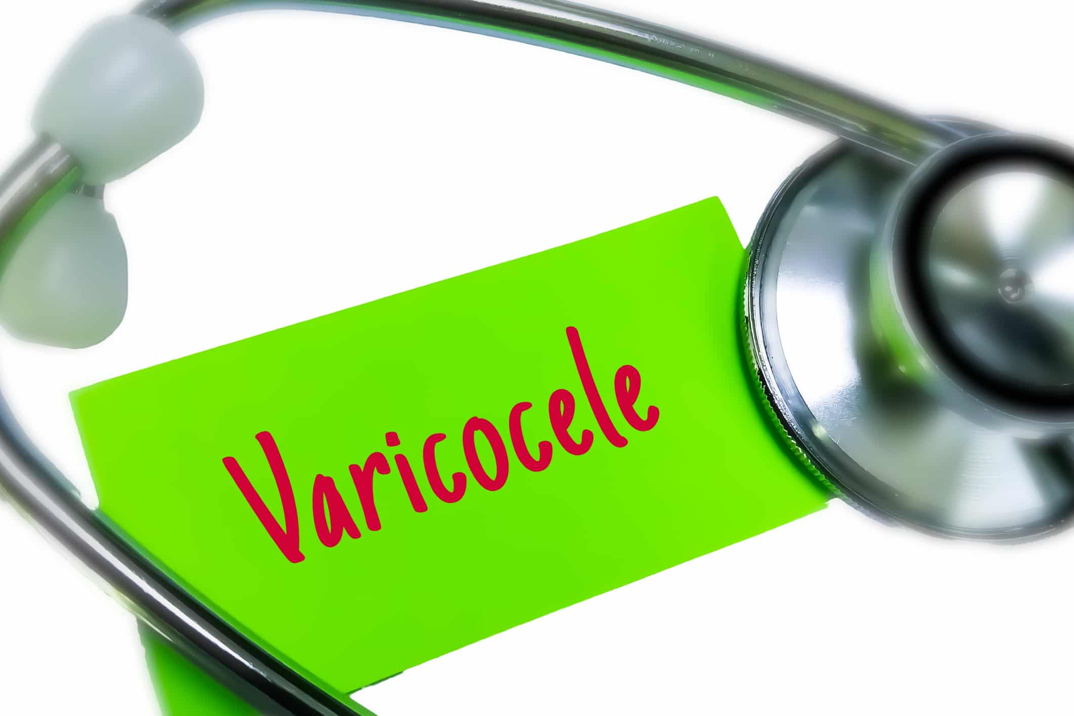 Scrotal Discomfort or Fertility Concerns (Possible Varicocele) Scrotal Discomfort or Fertility Concerns Possible Varicocele